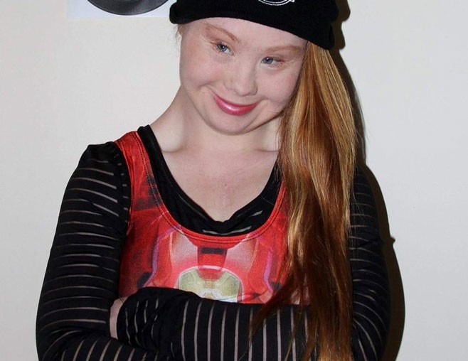 Madeline “Maddy” Stuart tiene síndrome de Down y 18 años de edad, a pesar de las limitaciones decidió convertirse en modelo publicitaria.